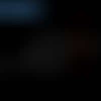 Allgemeine Grundstruktur der Nonylphenolethoxylate.&nbsp;
