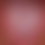 Lichen planus mucosae: multiple, chronically active (for about 1 year), extensive, partly conflue...