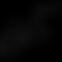 Structural formula of squalene.
