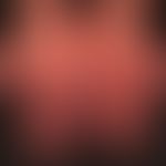 Systemic lupus erythematosus: characteristic "collagenosis hands" with variable blue-red and livi...