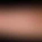 Epidermodysplasia verruciformis: disseminierte und generalisierte Aussaat von flachen (planen War...