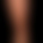 Granuloma anulare disseminatum: non-painful, non-itching, disseminated, large-area plaques that a...