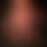 Erythrodermie: schwere Onychodystrophie (Onychgrypose) bei mehrjährig bestehender Erythrodermie b...