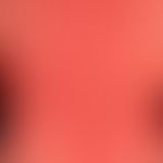 Arzneimittelexanthem&nbsp;makulo-papulöses:&nbsp; naehzu erythrodermisches,&nbsp;&nbsp;seit wenig...