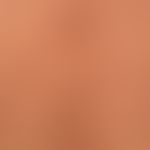 Nodules: clinical diagnosis: peripheral neurofibromatosis: multiple differently sized soft, broad...