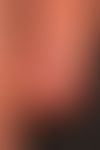 Normales&nbsp;Nagelorgan: glatte Nagelplatte, normal ausgebildetes anliegendes Nagelhäutchen (Epo...