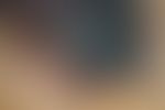Nagelhämatom: auflichtmikroskopisches Bild.
