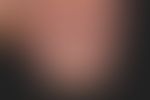 Streifige Onychodystrophie:&nbsp;harmlose,&nbsp;altersbedingte streifige Onychodystrophie (Längsr...