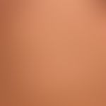 Urticaria pigmentosa: general view: about 0.5-1.0cm large, disseminated, oval or round, brownish-...