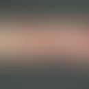 Steroid purpura: traumatically caused older and fresh skin bleeding, in a 68-year-old patient wit...