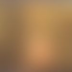 Cylindrome: firm, elastic, hairless knot with reflecting surface, which has not grown in recent y...