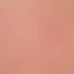 Urticaria pigmentosa: classic form of Urticaria pigmentosa (type I), disseminated, flat, oval or ...
