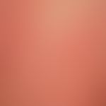 Urticaria chronic spontaneous: multiple, chronically recurrent, reddish wheals confluent to large...