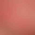 Acute urticaria: Acute exanthema with multiple, disseminated red wheals, which in places flow tog...