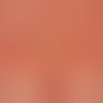 Urticaria chronic spontaneous: multiple, chronically recurrent, red, partly confluent wheals; sev...
