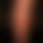 Lichen planus exanthematicus. for 2 months persistent, itchy, generalized, dense itchy rash with ...