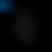Strukturformel von D-Ribose
