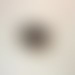 Pigmentierter&nbsp;Spindelzellentumor (Nävus Reed) - dermatoskopisches Bild: asymetrisch, zentral...