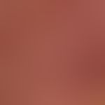 Systemic lupus erythematosus: Detailed view of the protruding follicular structure in the area of...