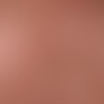 Lichtermatose polymorphe (akneiform): Detailaufnahme mit juckenden und brennenden, disseminierten...