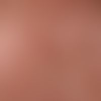 Lichtermatosis polymorphic: detailed view with itching and burning, disseminated papules, papulo-...
