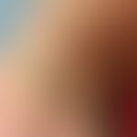 Pseudoxanthoma elasticum: Totally asymptomatic, reticular, yellowish papules and plaques on the e...