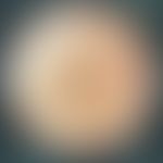 Pseudoxanthoma elasticum: Dermatoscopic picture of the right neck with translucent, yellowish-whi...