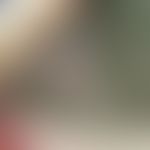 Naevus sebaceus: 25jähriger Mann. Die rötlich-bräunliche, mit weißlichen Papeln durchsetzte, völl...