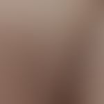 Miliaria cristallina: after strenuous physical activity, these disseminated, to pinhead-sized, wa...