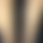 Flashlamps (side effects of the therapy): streaky hypopigmentation after IPL depilation, hair gro...