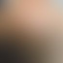 Talgdrüsenepitheliom: langsam wachsender, hautfarbener, nicht schmerzhafter, fester Knoten. &nbsp;
