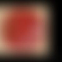 Kulturen von Staphylococcus aureus und Staphylococcus epidermidis
