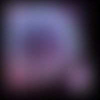 Coronavirus: Computermodell des Virus&nbsp;
