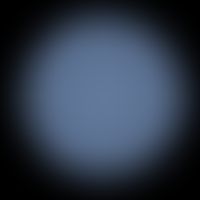 Togaviridae: a computer simulation of the Rubella virus, with bump-like protrusions corresponding...