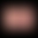 Lymphoepitheliom-ähnliches Karzinom: unspektakuläres klinisches Bild mit glasig erscheinendem fes...
