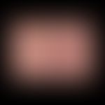 Lymphoepitheliom-ähnliches Karzinom: unspektakuläres klinisches Bild mit glasig erscheinendem fes...