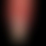 Scleronychia: combined form of scleronychia with combined milky diffuse leukonychia, underlying c...