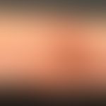 Cytostatic drugs: Extravasation after application of a cytostatic drug
