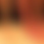 acrodermatitis chronica atrophicans: 69-year-old woman. for 4 months right lower leg flat livid-r...