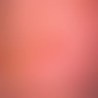 Blistering and crust formation: flat multilocular blistering in massive large-area dermatitis sol...