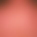 Dermatitis solaris: scharf auf Sonnenlicht-exponierte Areale gezeichnete, flächenhafte, schmerzha...