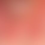 Dermatitis solaris: scharf auf Sonnenlicht-exponierte Areale gezeichnete, flächenhafte, schmerzha...