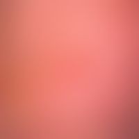 Kruste: akute blasenbildende Dermatitis solaris; gelbliche Krustenauflagerungen.&nbsp;
