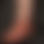 Lichen planus verrucosus with transition into a lichen palnus ulzerosus: verrucous and hyperkerat...