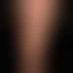 Livedo racemosa: irregular, bizarre, not closed circular segments (ankle region), as pioneering m...