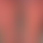 Varizellen:&nbsp;generalisiertes Exanthem (Aspekte des Erythema multiforme)&nbsp;mit Nebeneinande...