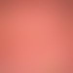 2nd degree burn (Combustio bullosa): Erythema followed by extensive subepidermal blistering. Begi...