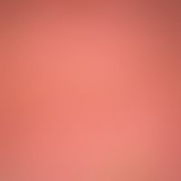 Verbrennung 2. Grades (Combustio bullosa): Erythem mit nachfolgender, flächenhafter subepidermale...