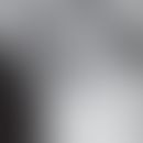 Soor esophagitis radiological findings: extracted from: Mohamed AA et al (2019) Diagnosis and Tre...