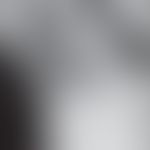 Soorösophagitis radiologischer Befund: entommen aus: Mohamed AA et al. (2019) Diagnosis and Treat...